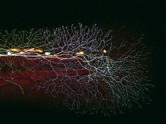 斑马鱼幼体轴突